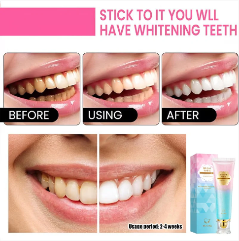 Niacinamide Whitening Toothpaste - For Teeth Whitening & Health!