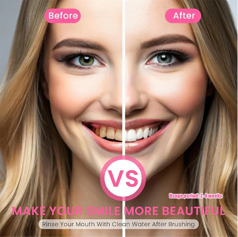 Niacinamide Whitening Toothpaste - For Teeth Whitening & Health!